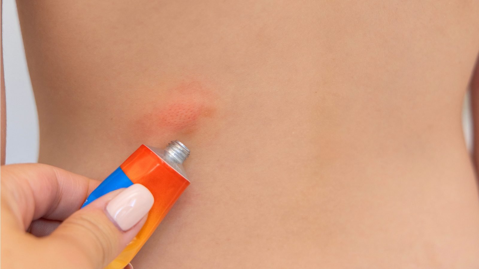 Żel w tubce na ukąszenia